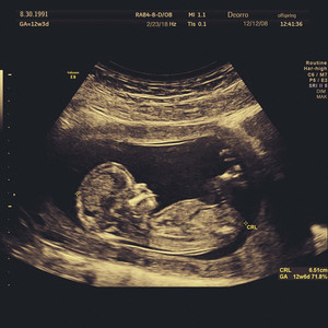 偷窃蹲便3免费观看全集
